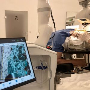 Haartransplantation Artas