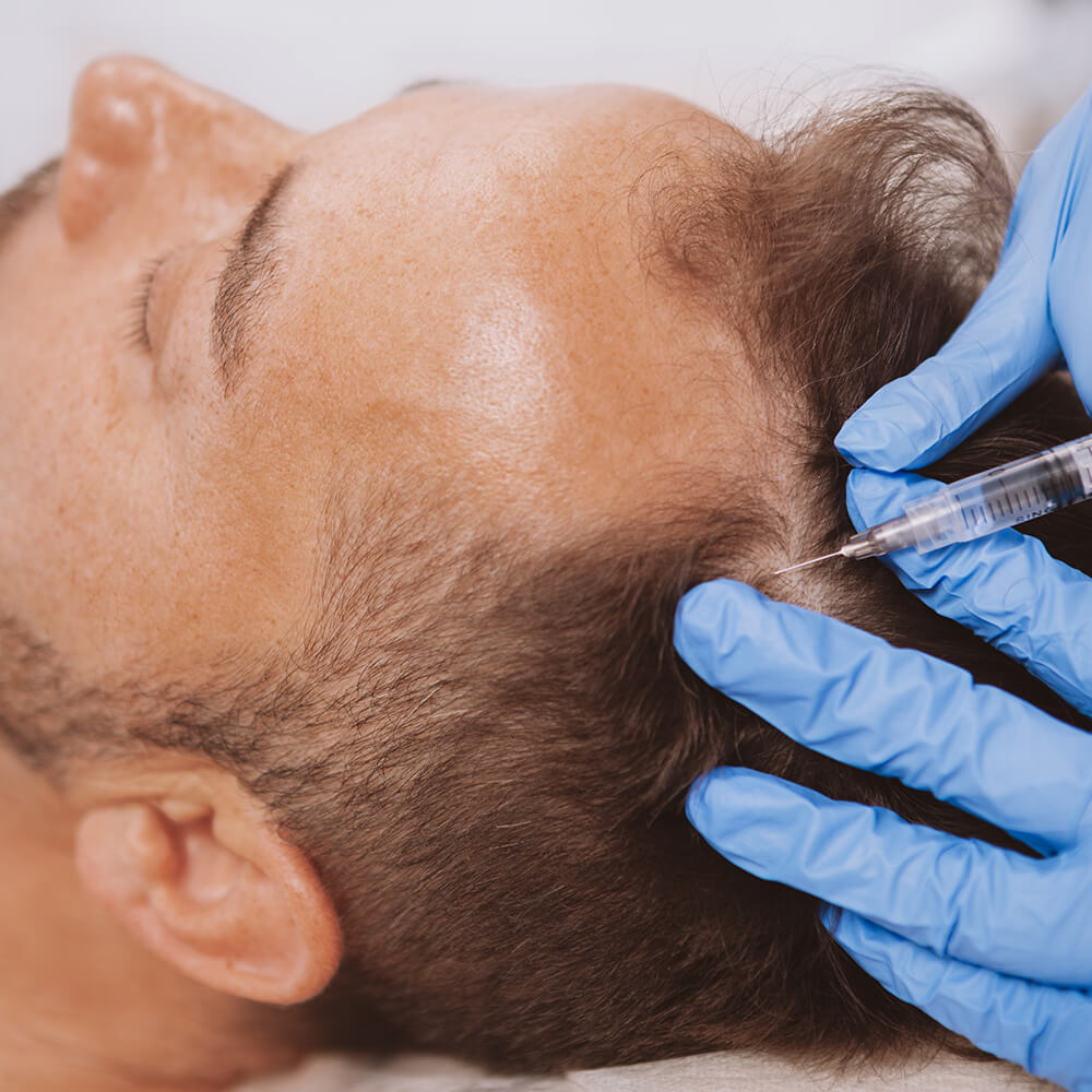 AC-Therapie in der Behandlung von Verspannungen und Haarwuchs