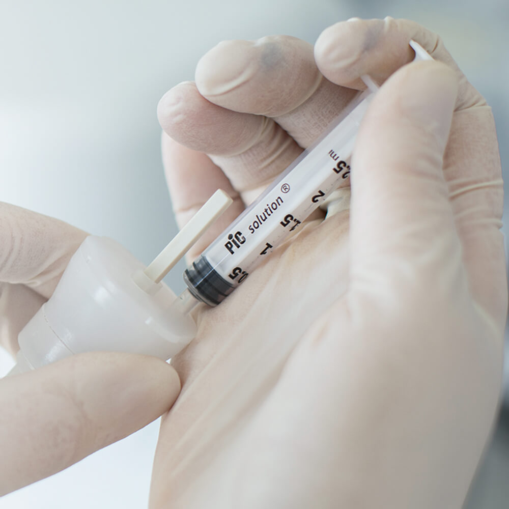 Regenera Activa – Stammzellentherapie bei genetisch bedingtem Haarausfall