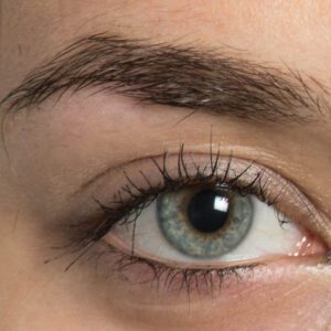 Augenbrauentransplantation