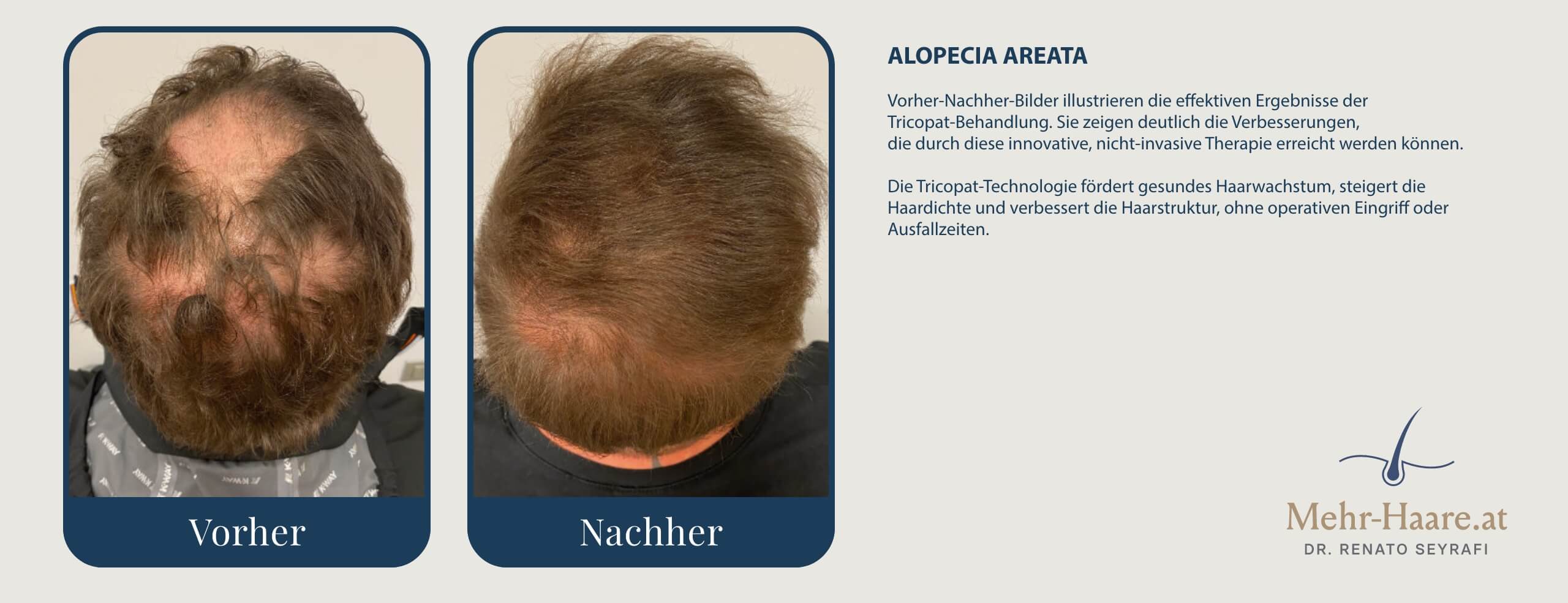 Nachher