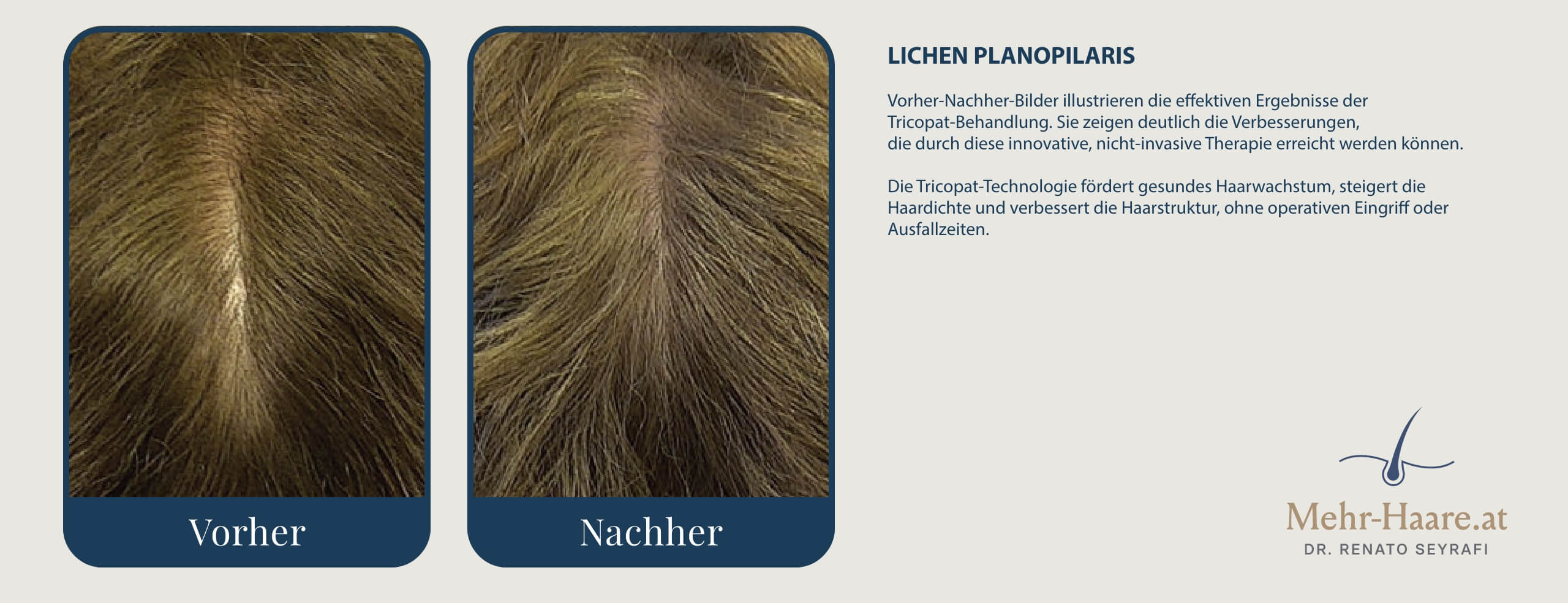 Nachher